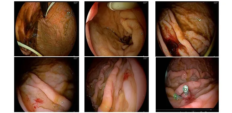 from clipboard